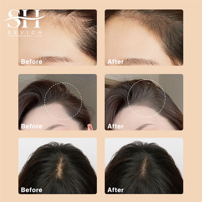 Sevich 5 Colors 12g Hair Shado - Rooting Hormone Powder ulasan dan harga